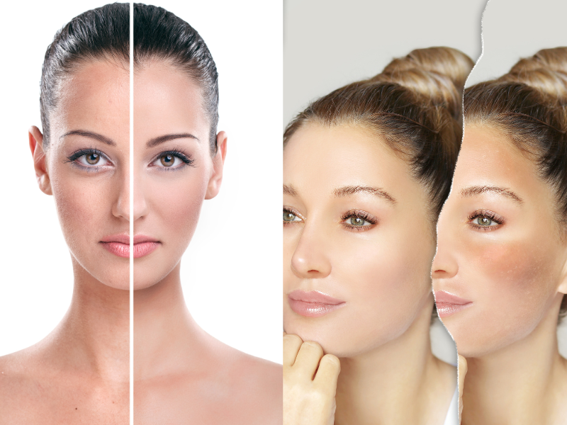About Your Skin Type